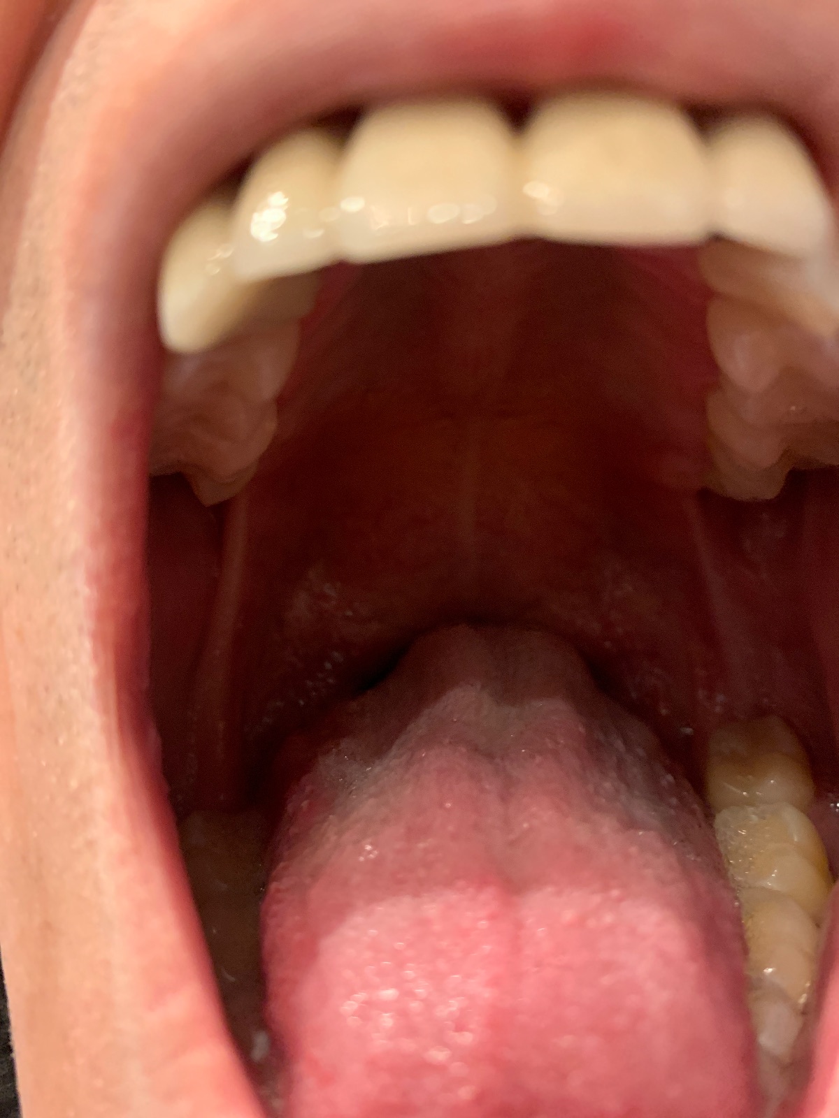 My mouth